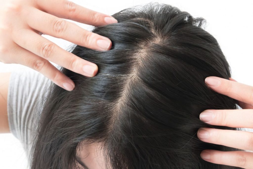 Tips Merawat Rambut Agar Terlihat Lebih Tebal